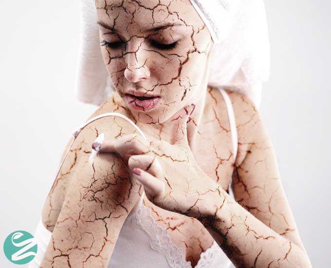 10 مرطوب کننده پوست برای درمان خشکی پوست