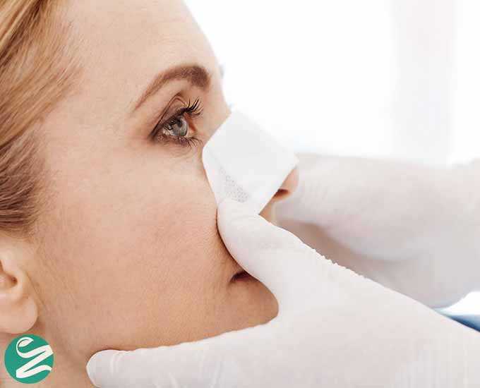 9 عوارض شایع عمل بینی + عوارض عمومی و خاص
