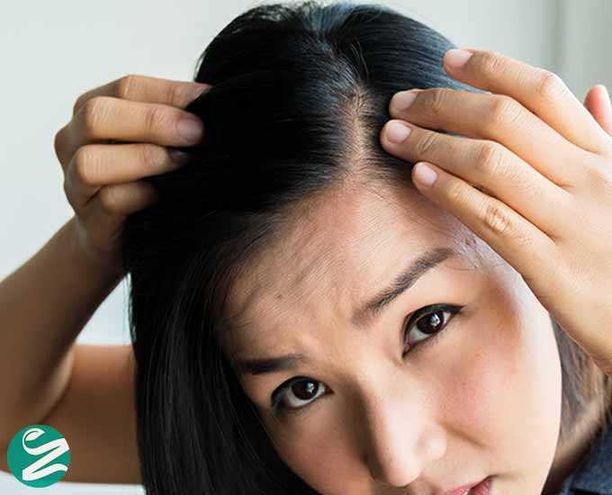 آیا کمبود آهن می‌تواند باعث ریزش مو شود؟