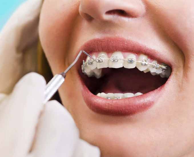 متخصص ارتودنسی کیست و چگونه برای ما یک لبخند زیبا خلق می‌کند؟