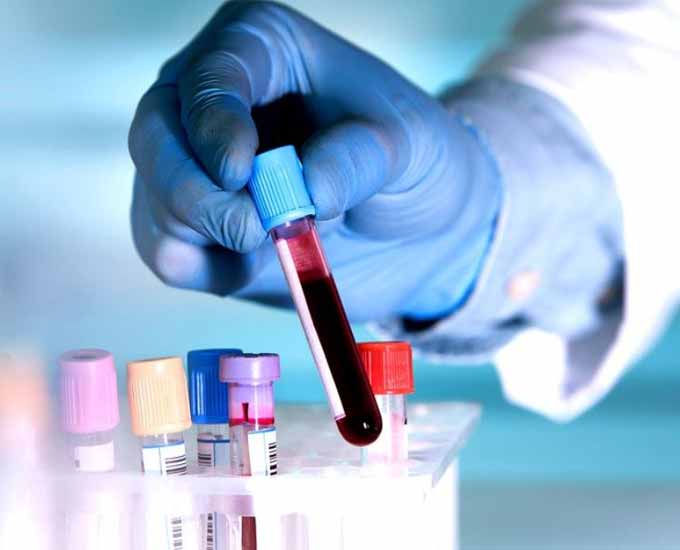 مراحل آزمایش خون برای ازدواج