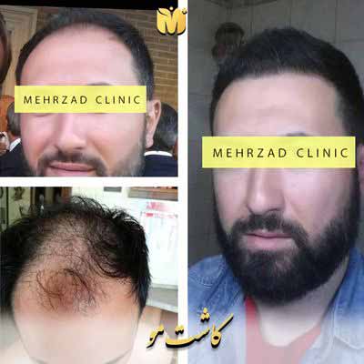 کاشتfut کاشتfut