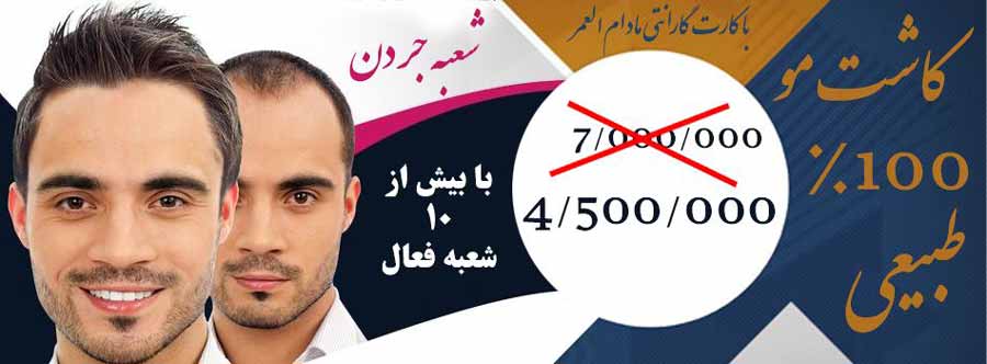 روش های کاشت مو چیست روش های کاشت مو چیست