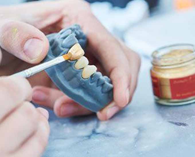 پرفروش‌‌ترین و معتبرترین مواد ترمیمی کدام برند است؟