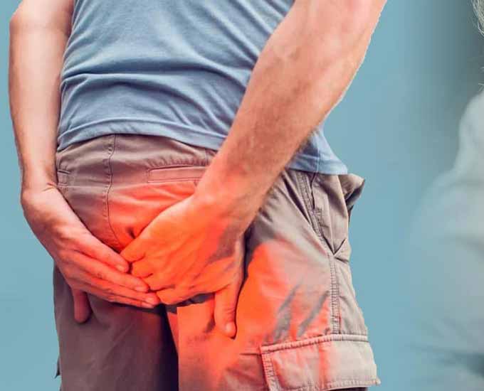 هموروئید بیماری که همه از گفتن آن شرم دارند