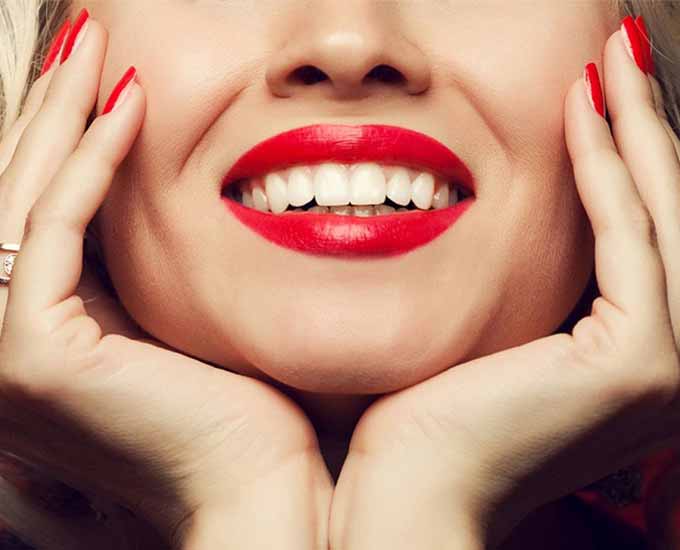 لمینت دندان چیست؟