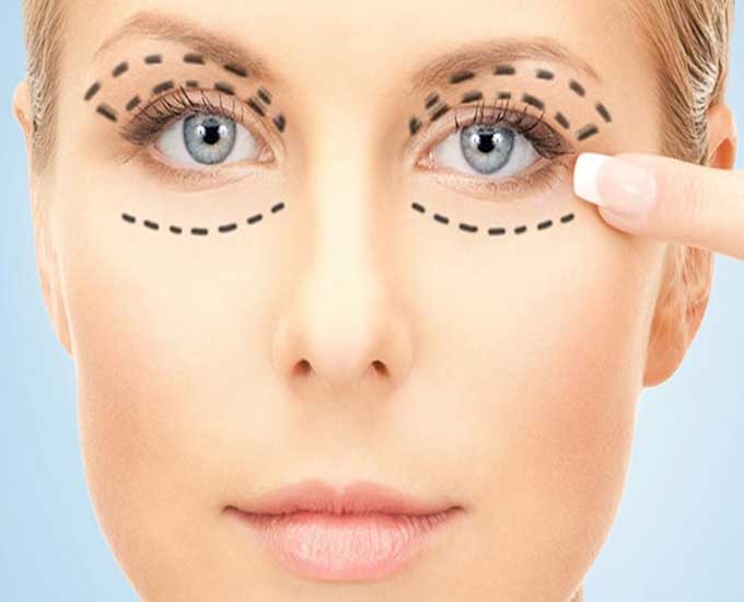 آیا برای حذف عینک محدودیت سنی وجود دارد؟