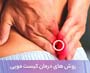 روش های درمان کیست مویی