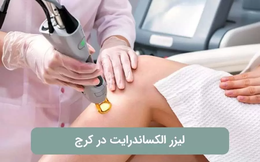 لیزر الکساندرایت در کرج و هرآنچه که باید بدانید