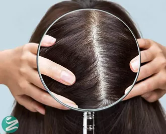 پیاز مو چیست و چطور تقویت می‌شود؟