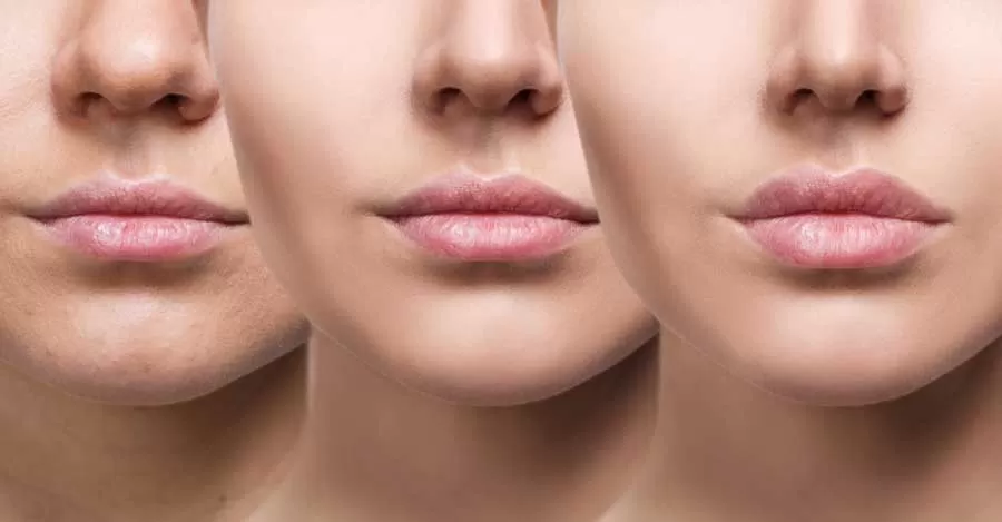 روش‌های مراقبت از فیلر لب برای ماندگاری بیشتر