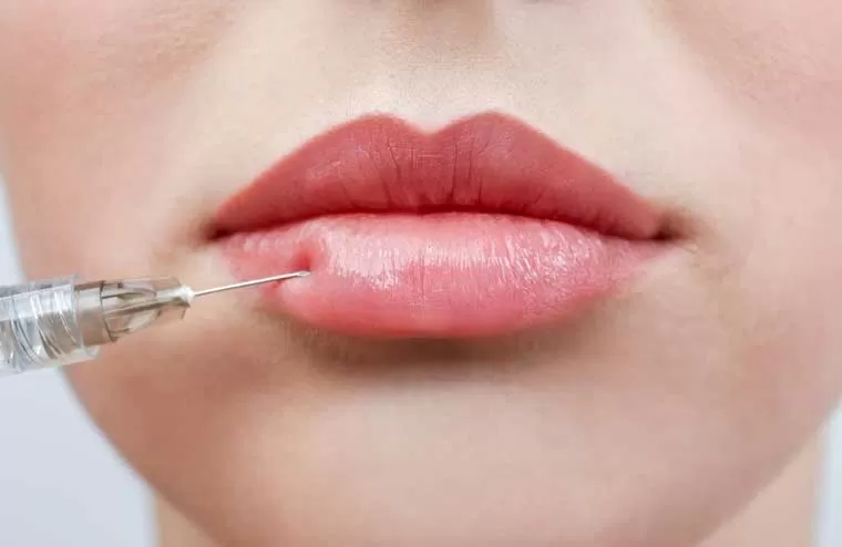 تزریق فیلر لب و مراقبت از آن