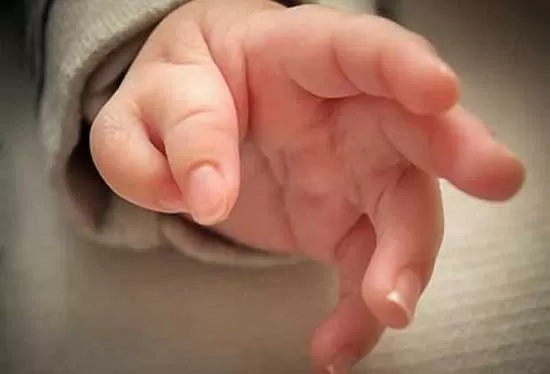 تشخیص و درمان بیماری های ارتوپدی کودکان