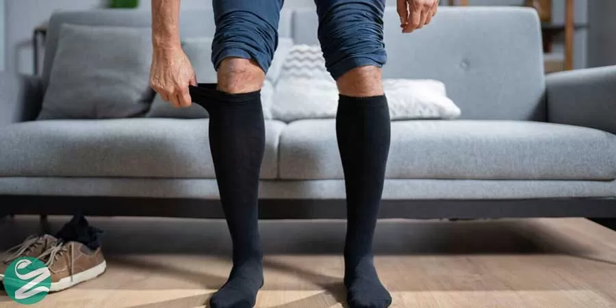جوراب واریس چیست و چه تاثیری روی واریس پا دارد؟