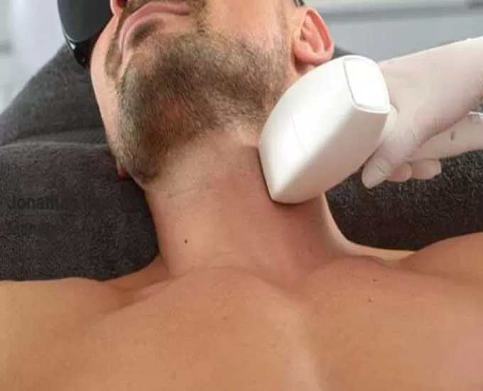 جدول قیمت لیزر موهای زائد در کرج در سال 1403