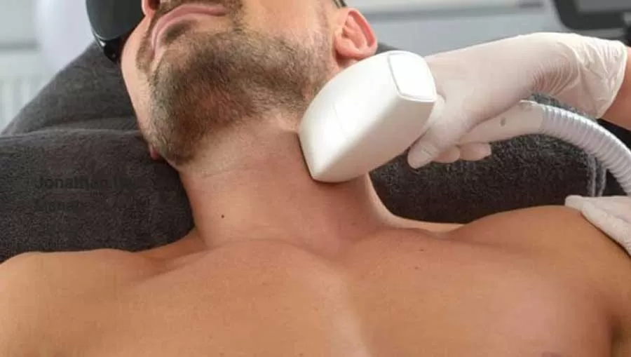 جدول قیمت لیزر موهای زائد در کرج در سال 1403