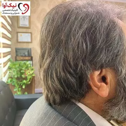 استفاده از سمعک نامرئی