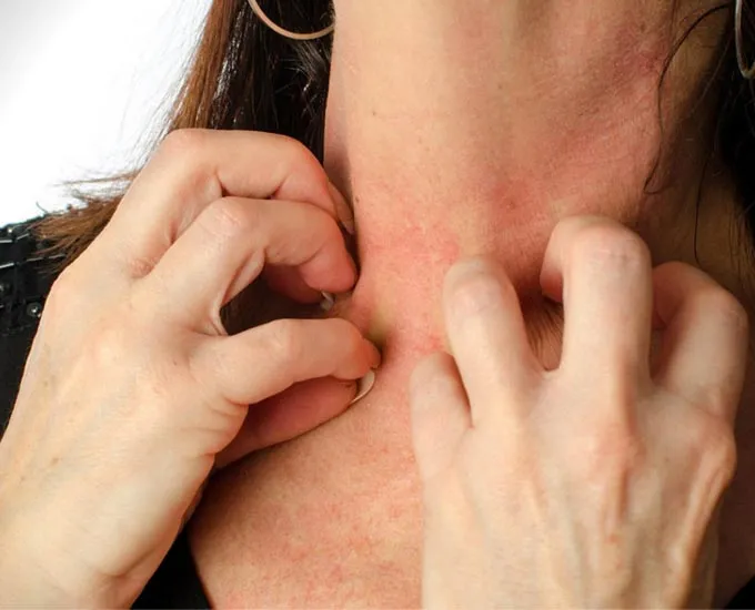 حساسیت به طلا | از علائم تا روش های درمان