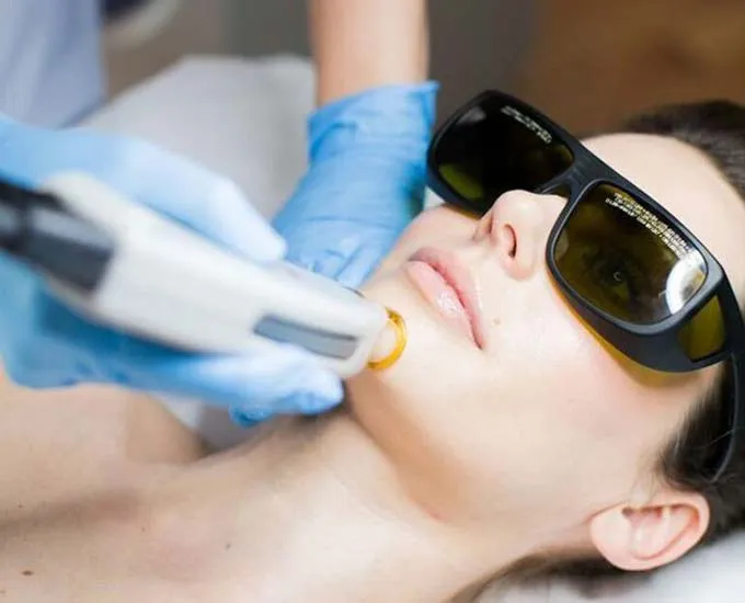 علت جوش زدن بعد از لیزر مو های زائد