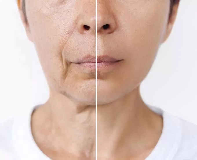 3 ضد چروک صورت کره‌ای که باید حتماً امتحان کنید
