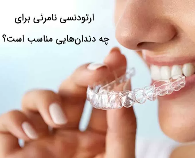 ارتودنسی نامرئی به چه کسانی توصیه می‌شود؟