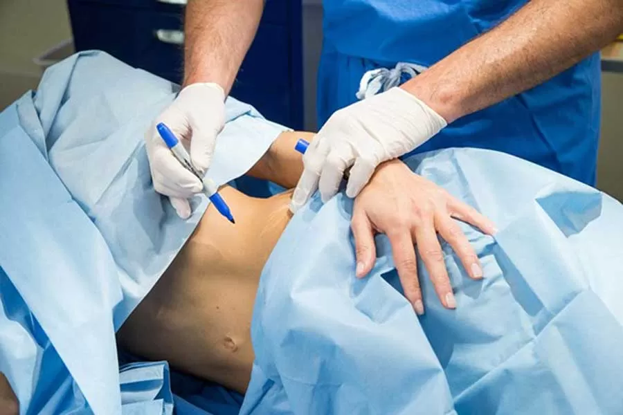 برای جراحی ابدومینوپلاستی کدام کلینیک را انتخاب کنیم؟