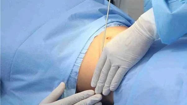 نکات مهم پیش از جراحی