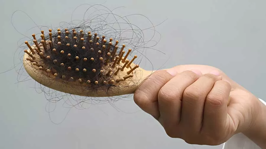 درمان ریزش مو در زنان؛ از علت تا راهکارهای نوین