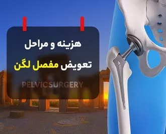 هزینه و مراحل تعویض مفصل لگن در شیراز (معرفی پزشکان)