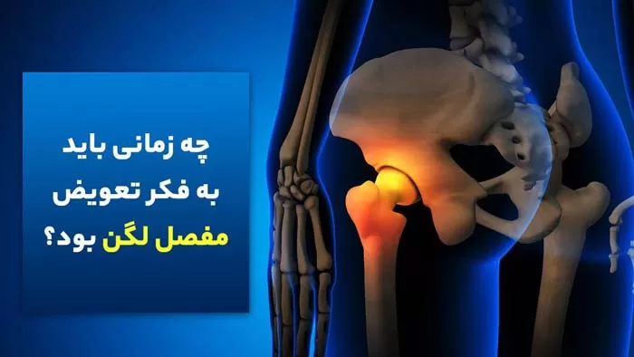 چه زمانی باید به فکر تعویض مفصل لگن بود؟