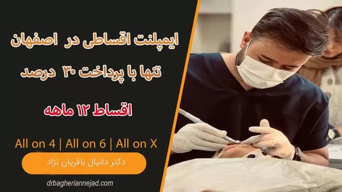 ایمپلنت اقساطی در اصفهان