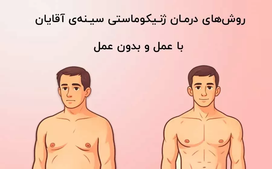 این عمل مردانه ترند شده; درمان ژنیکوماستی با عمل و بدون عمل