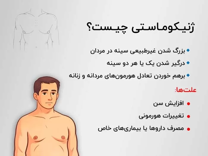 ژنیکوماستی چیست؟ و چه عواملی باعث بروز آن می‌شود؟