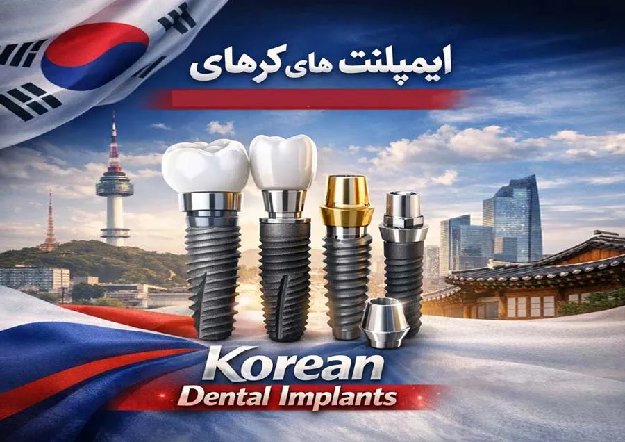 انواع برندهای ایمپلنت کره ای + [لیست قیمت به روز]