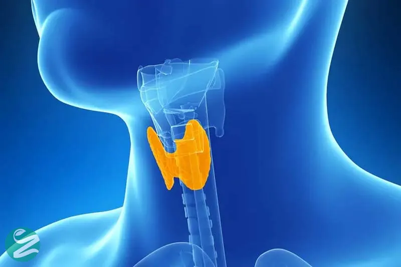 دلایل افزایش وزن ناخواسته؛ کمکاری تیروئید (Hypothyroidism)