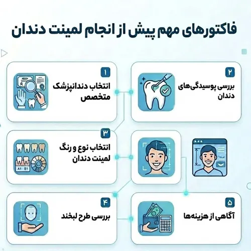 نکات مهم قبل از لمینت دندان