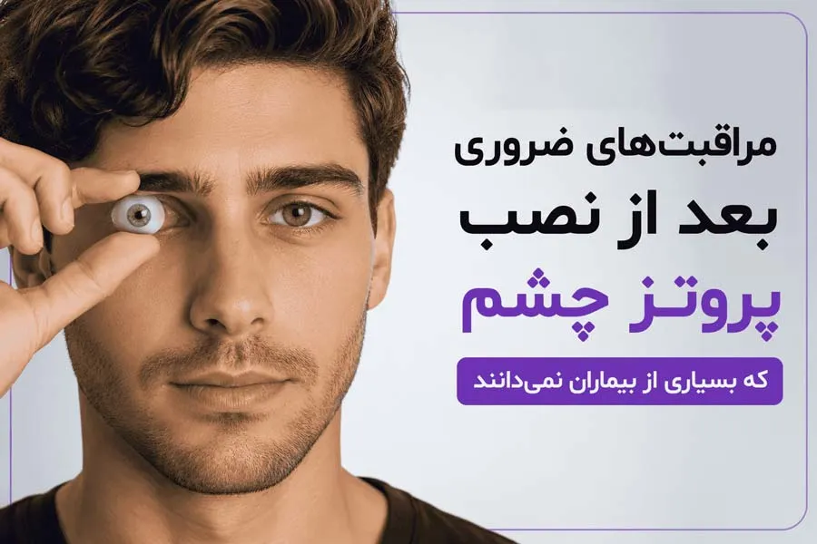 مراقبت‌های ضروری بعد از نصب پروتز چشم که بسیاری از بیماران نمی‌دانند