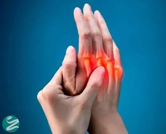 آرتریت روماتوئید چیست؟ علائم، تشخیص و روش‌های درمان