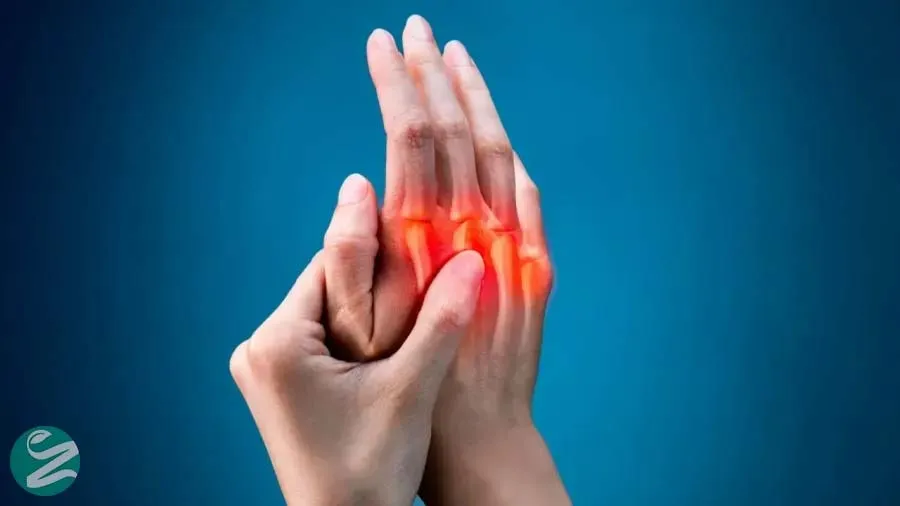 آرتریت روماتوئید چیست؟ علائم، تشخیص و روش‌های درمان