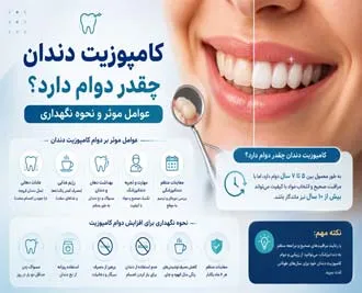 کامپوزیت دندان چقدر دوام دارد؟ عوامل موثر و نحوه نگهداری