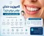 کامپوزیت دندان چقدر دوام دارد؟ عوامل موثر و نحوه نگهداری