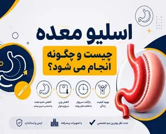 عمل جراحی اسلیو معده چیست و چگونه انجام می‌شود؟