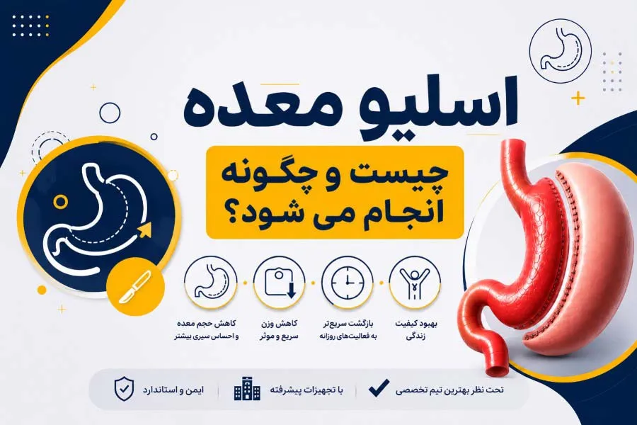 عمل جراحی اسلیو معده چیست و چگونه انجام می‌شود؟