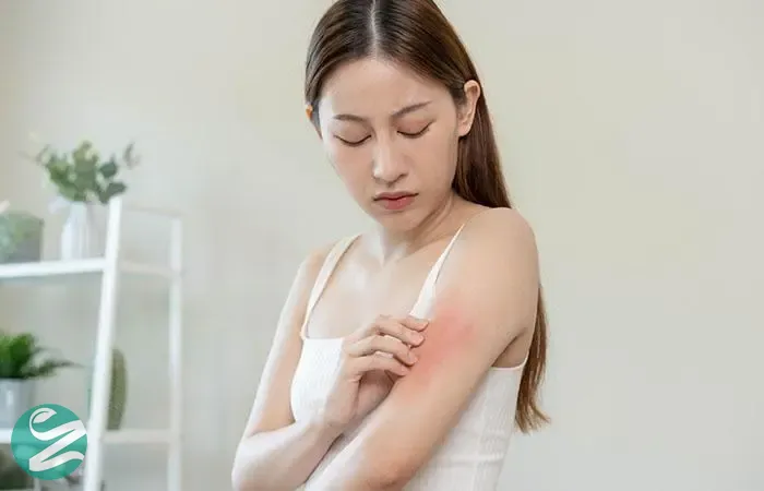 زن در حال تجربه حساسیت به سیب