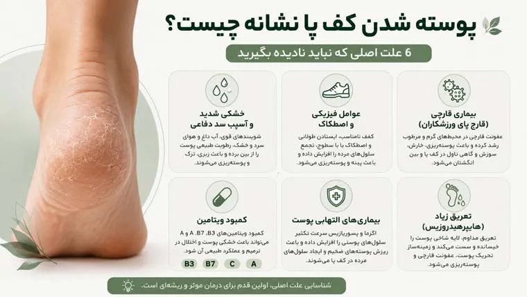 نشانه های پوسته شدن کف پا