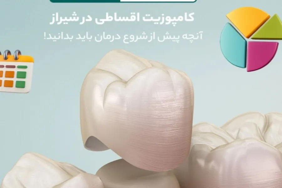 کامپوزیت اقساطی در شیراز؛ آنچه پیش از شروع درمان باید بدانید!