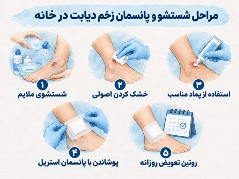 مراحل شستشو و پانسمان زخم دیابت در خانه